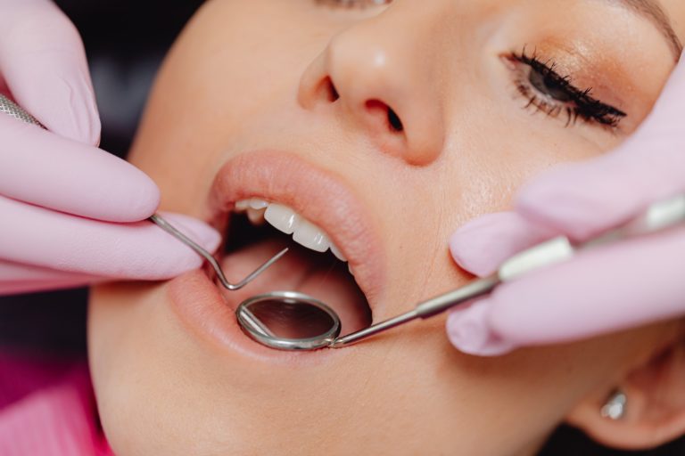 3 Warning Signs That You Might Need a Dental Crown