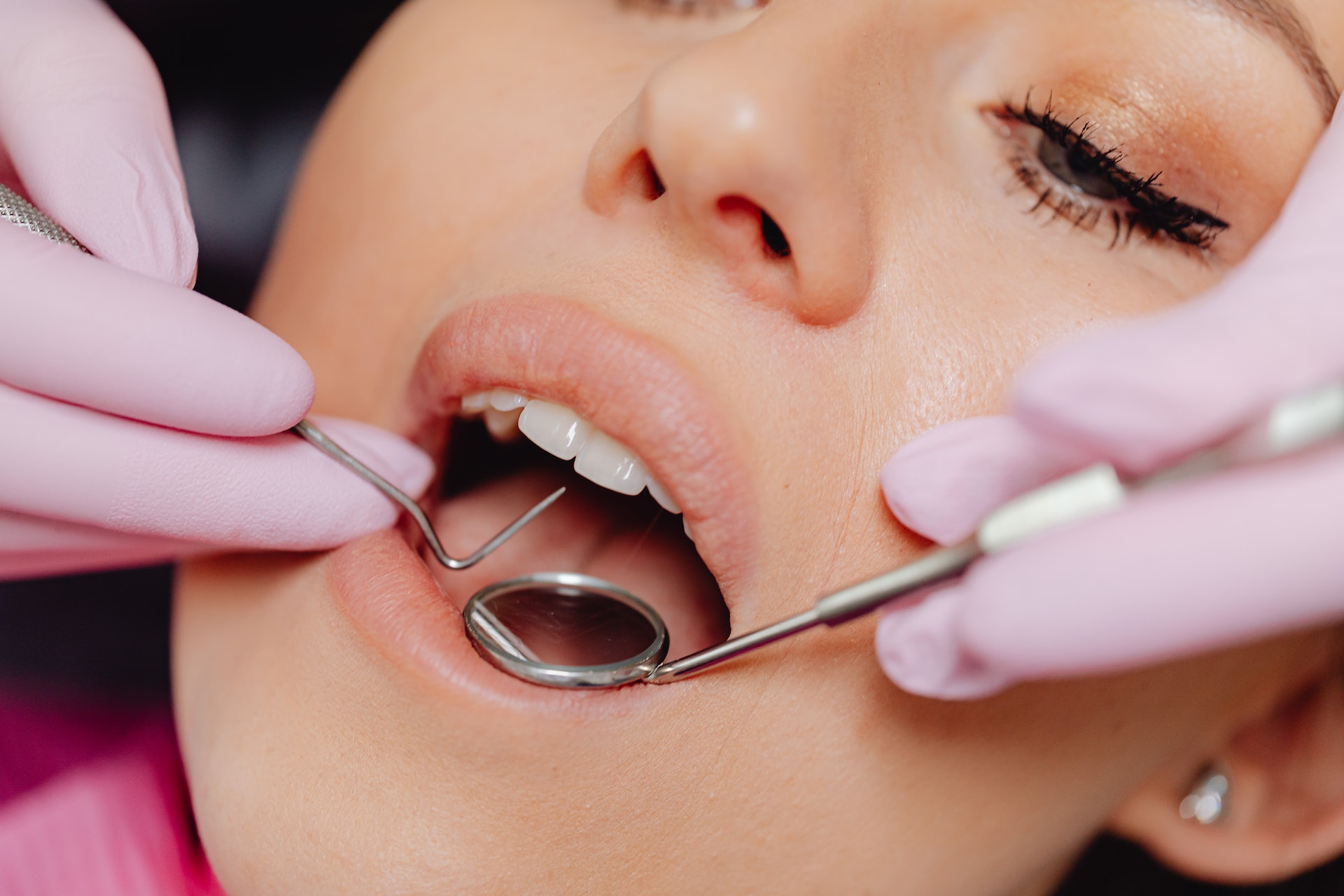 3 Warning Signs That You Might Need a Dental Crown
