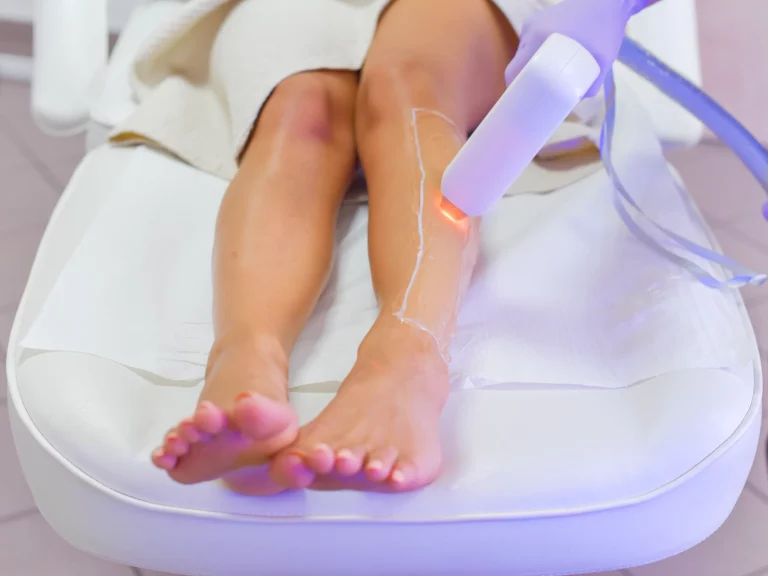 The Top Benefits Of Laser Hair Removal-Finger Lakes Dermatology’s Professional Opinion