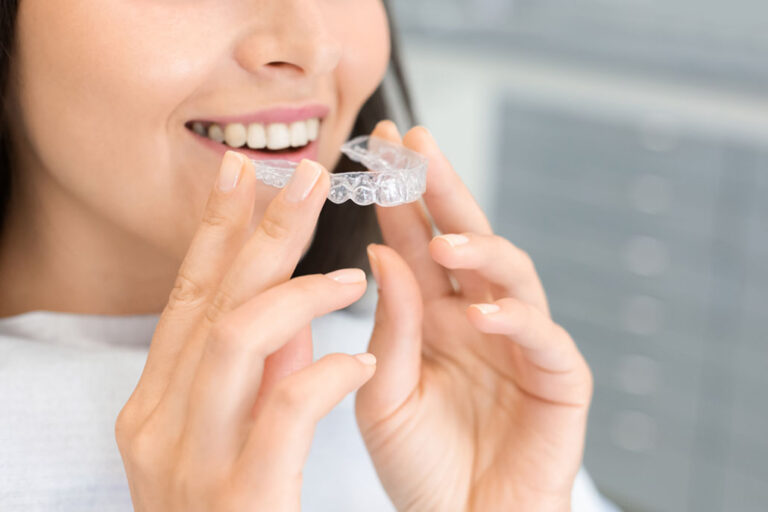Alternatives to DIY Teeth Straightening: Safe and Effective Options to Consider