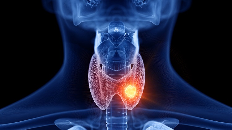 The 4 Essential Minerals Your Thyroid Can’t Function Without