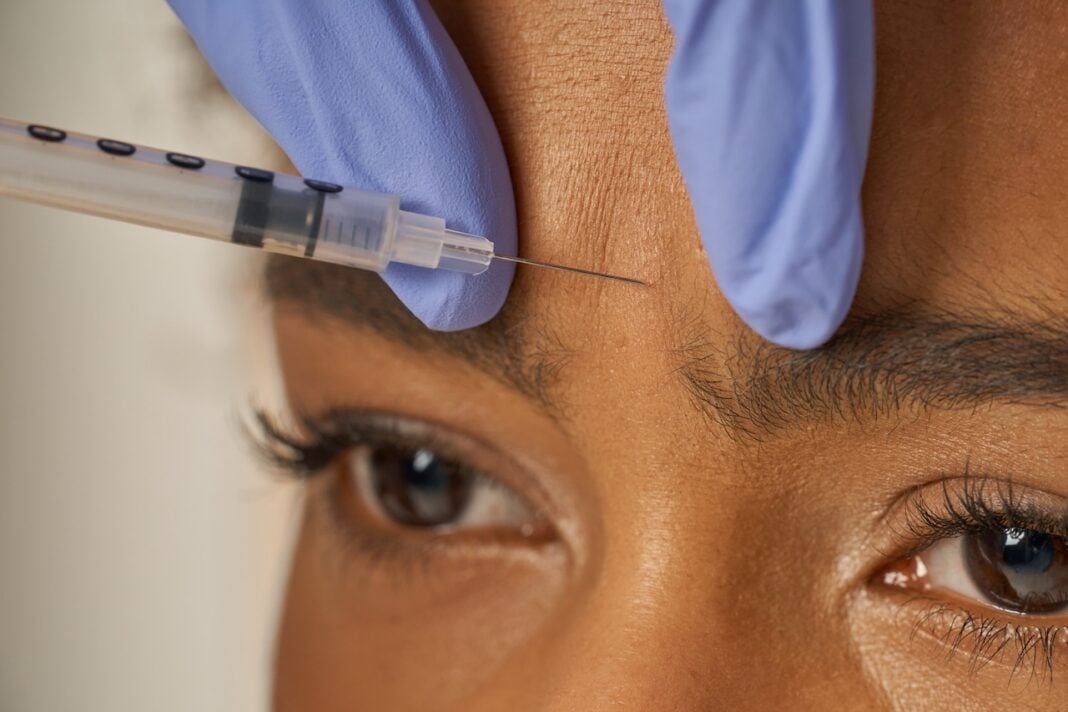How Soon Will I See Results After Botox?