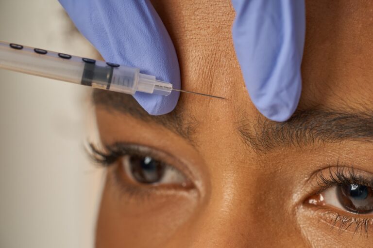How Soon Will I See Results After Botox?