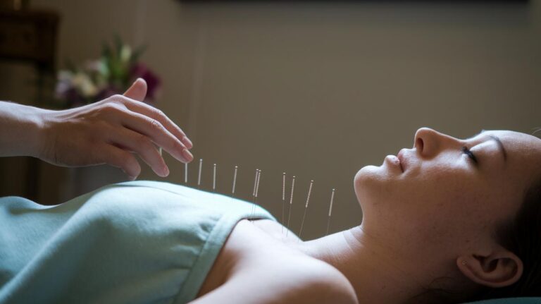 Acupuncture For Stress Management Offers Natural Relief
